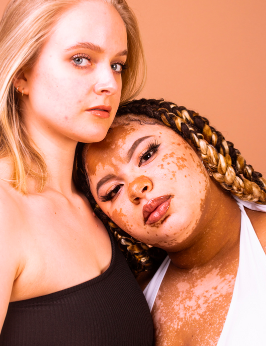 Our Story- The Heart Behind Embrace Beauty