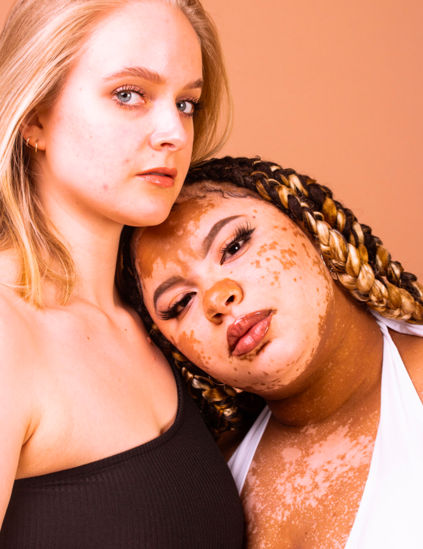 Our Story- The Heart Behind Embrace Beauty